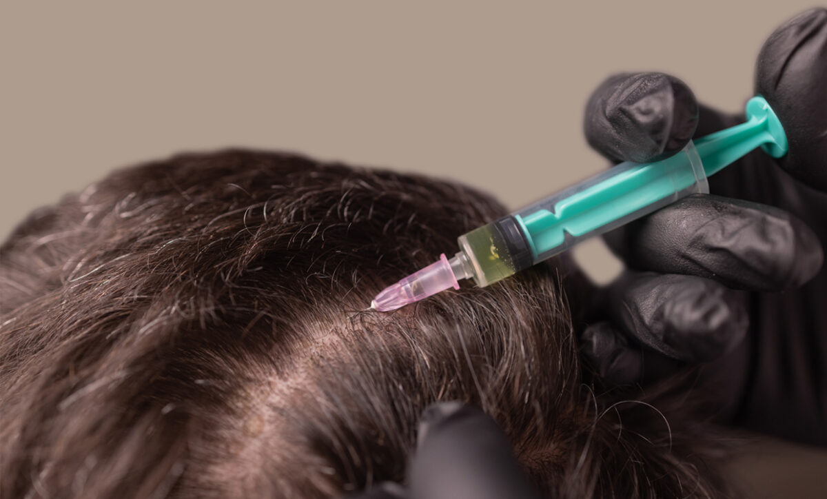 Do Exosomes Regrow Hair?